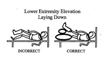 Lower Extermity Elevation Laydown