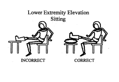 Lower Extermity Elevation Sitting