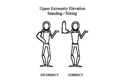 Upper Extermity Elevation